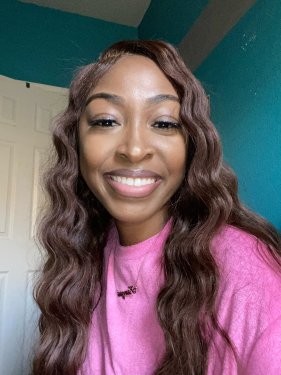 Desirae M. – Diagnosed at age 25 | Lupus Foundation of America